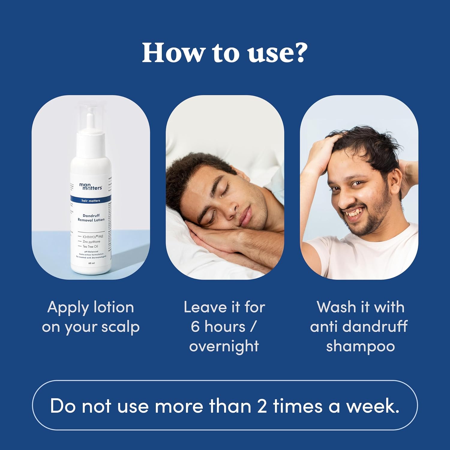 Man Matters Dandruff Removal Lotion