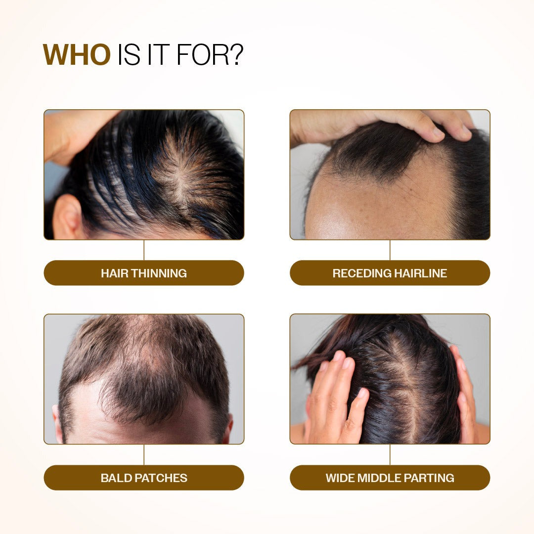 Bare Anatomy Advanced Hair Growth Serum Roll-On with Redensyl, Rosemary & Rice Water- 25 ml