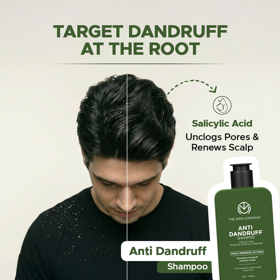 The Man Company Anti-Dandruff Shampoo for Men - 100ml