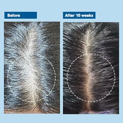 Be Bodywise Advanced Hair Growth Pack 60