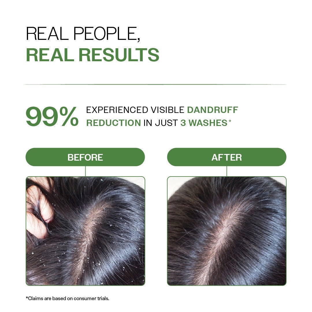Bare Anatomy Anti Dandruff Shampoo with Salicylic Acid & Biotin - Pack of 2