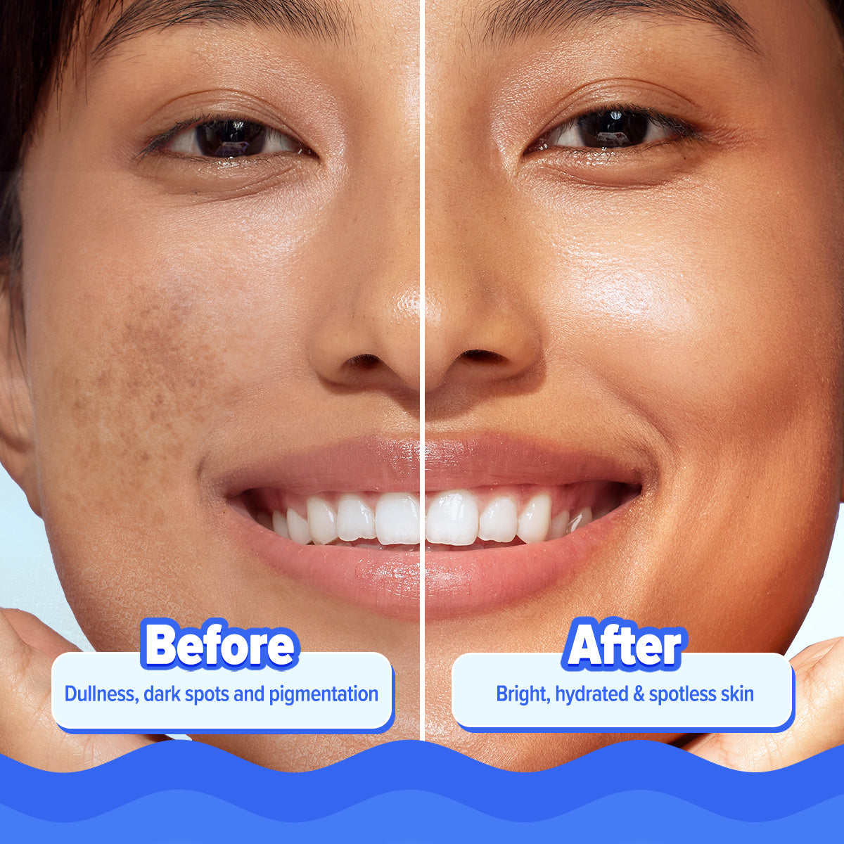 Aqualogica Bright+ Hydra Gel Moisturizer - 200g