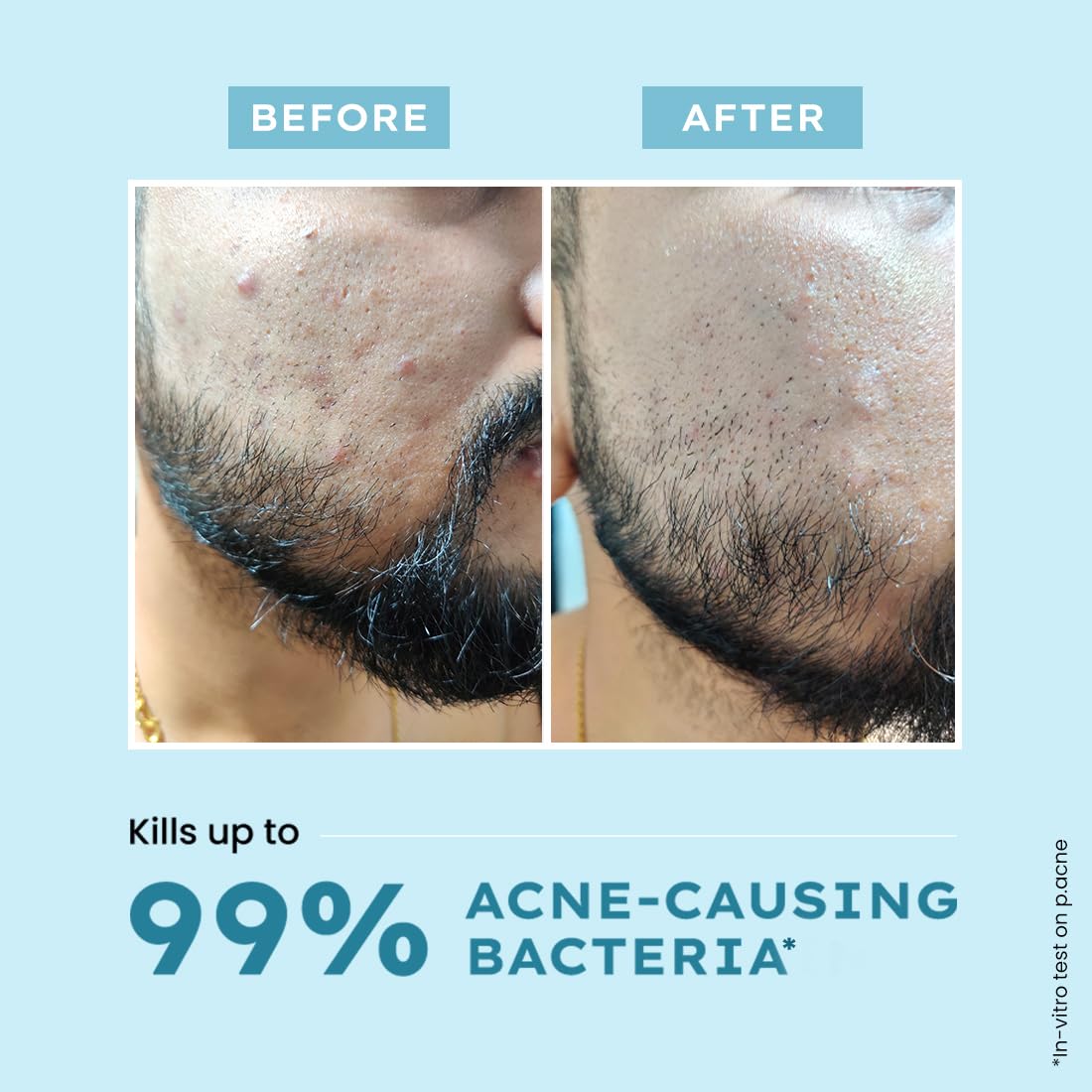 Hyphen Clarifying Acne Face Wash - 100ml