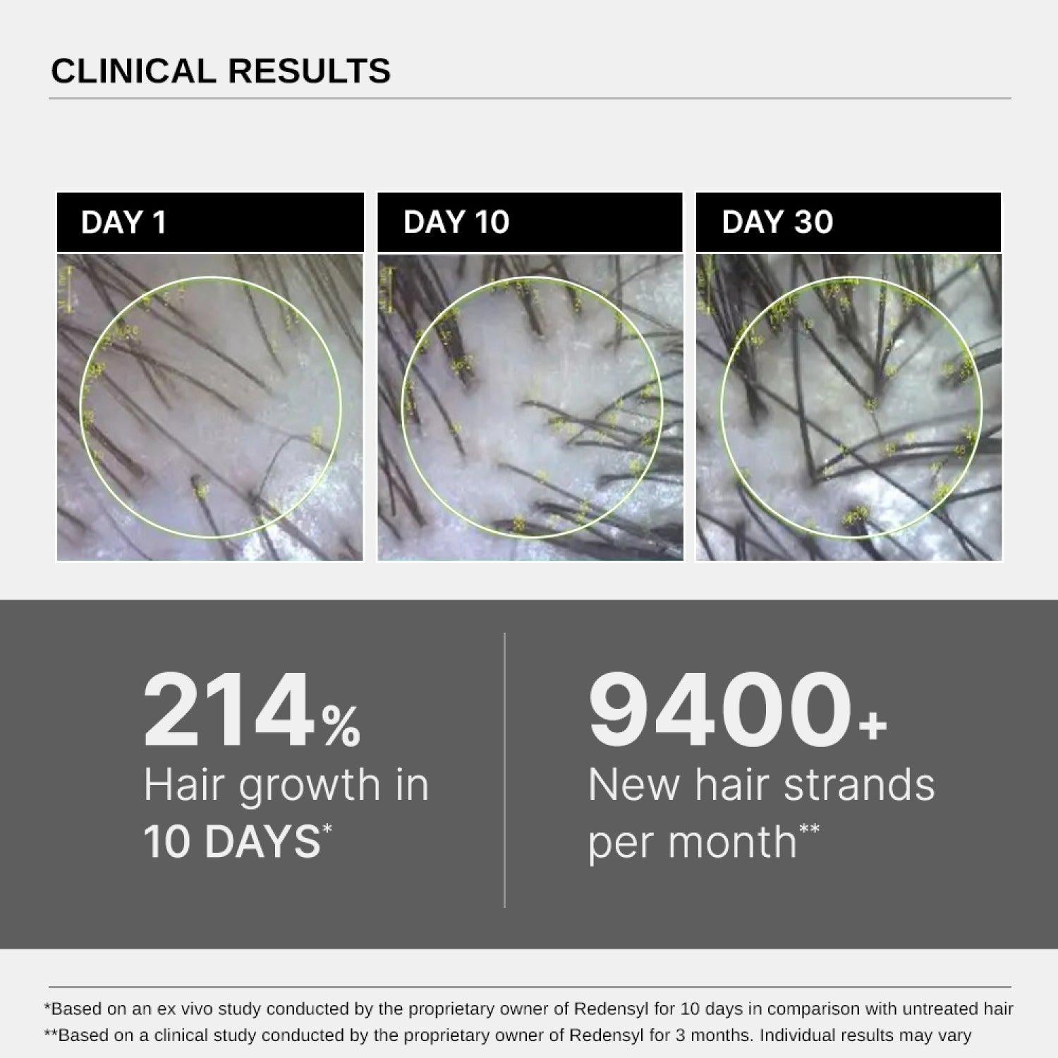 Bare Anatomy Advanced Hair Growth Serum (30 ml)