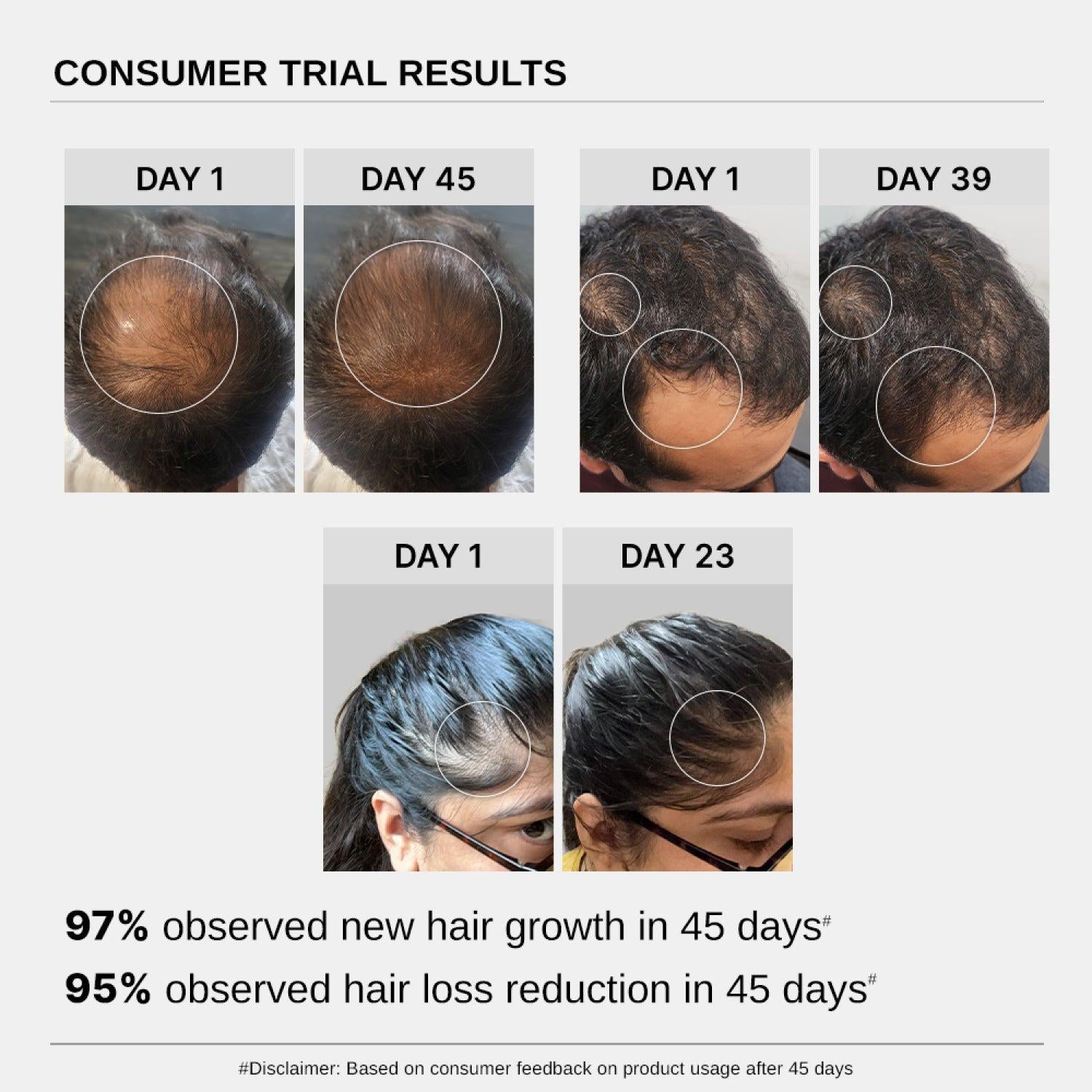 Bare Anatomy Advanced Hair Growth Serum (30 ml)