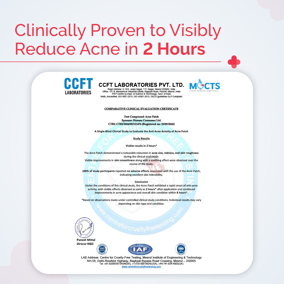 Derma Co 2% Sali-Cinamide Hydrocolloid Acne Patches - 36 Patches