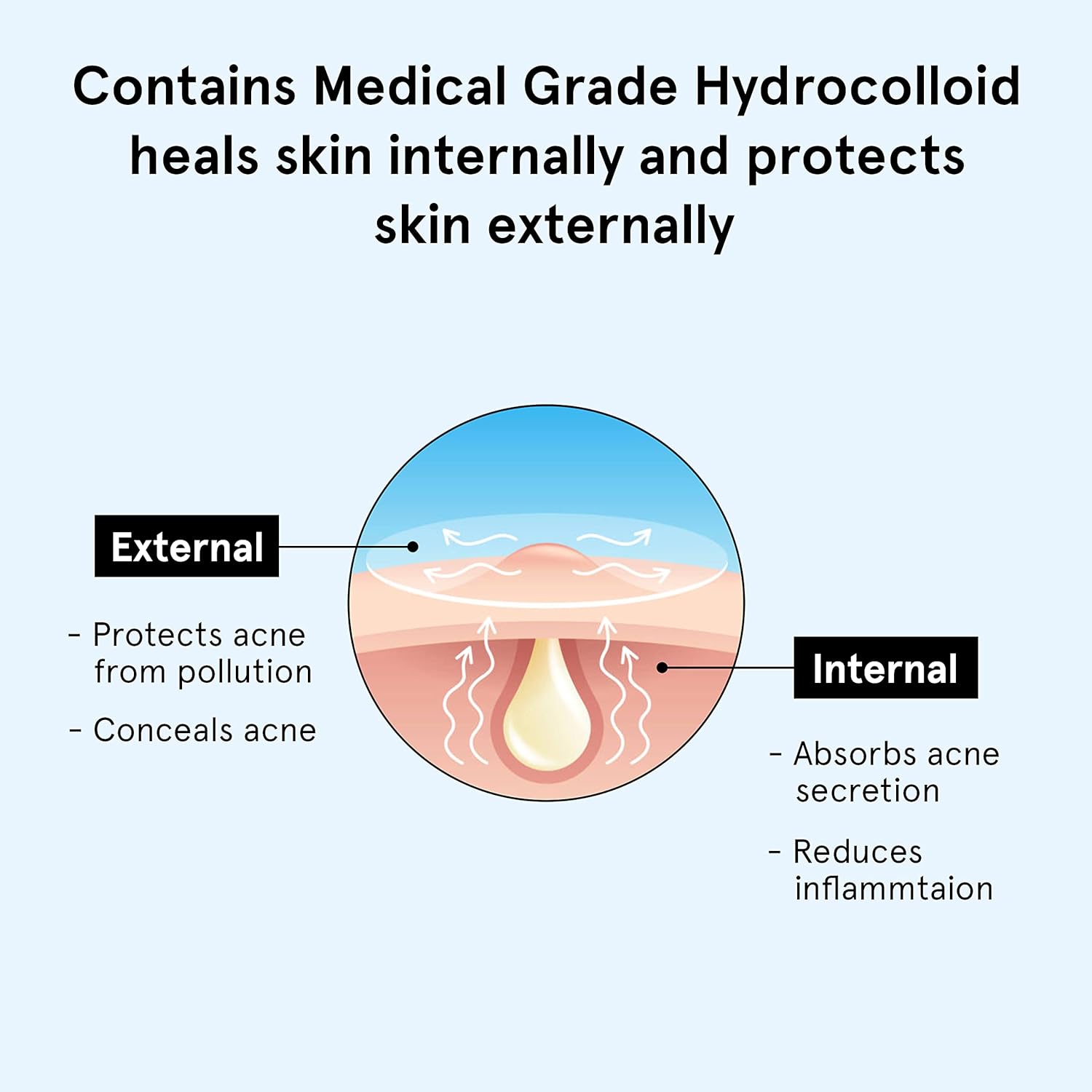 Be Bodywise Acne Pimple Patch