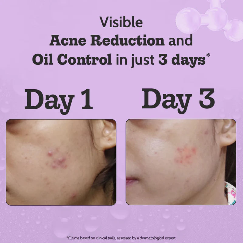 Chemist at Play 2% Salicylic Acid Serum