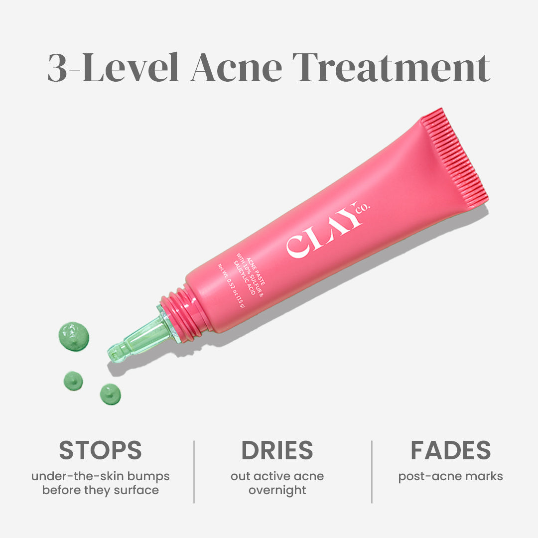 ClayCo Acne Paste with 10% Sulfur & Salicylic Acid - 15g - Pack of 2