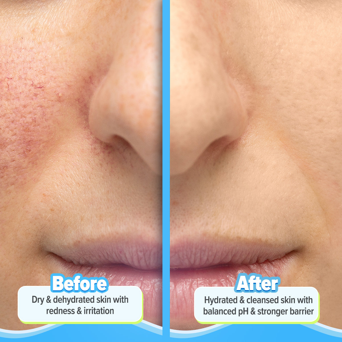 Aqualogica Barrier+ Repair Gentle Cleanser - 100ml