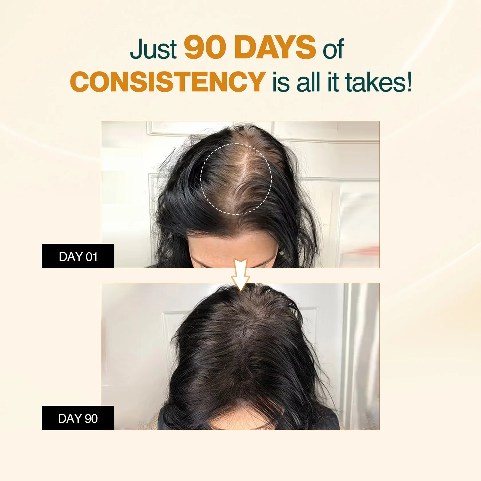 Nourish Mantra Advanced Hair Growth Serum with Rosemary Extract - Pack of 1