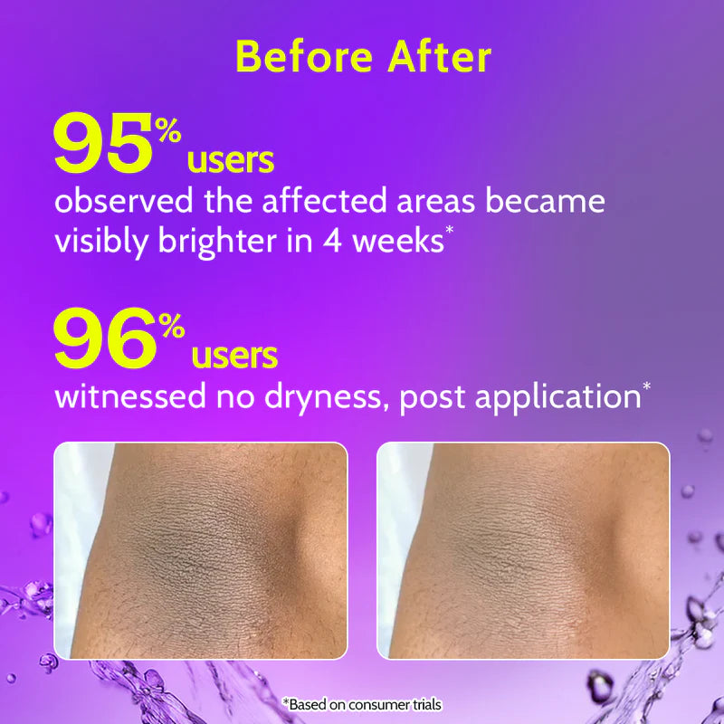 Chemist at Play Neck, Knee, Elbow Brightening Roll On