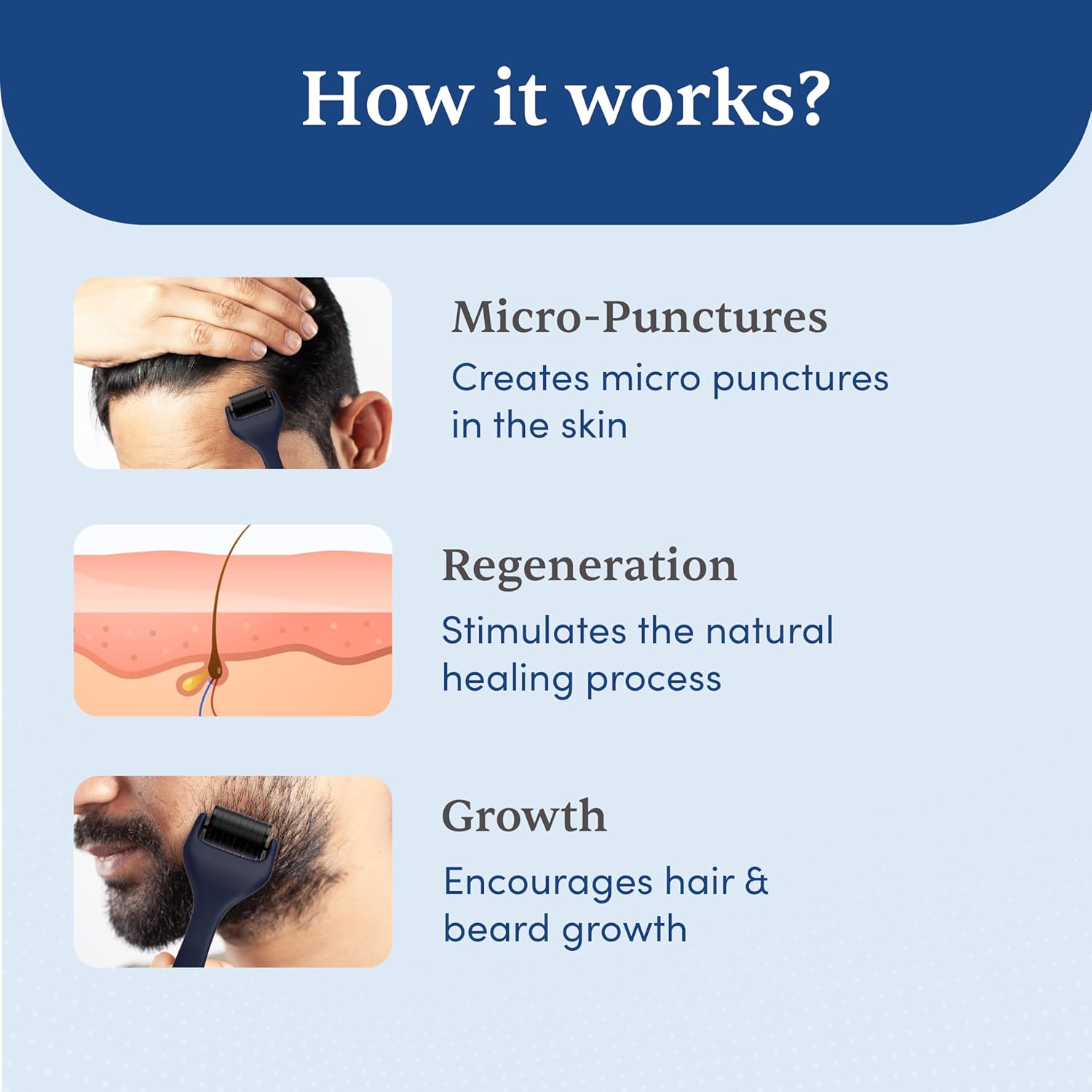 Man Matters Hair Activator+ (Derma Roller)