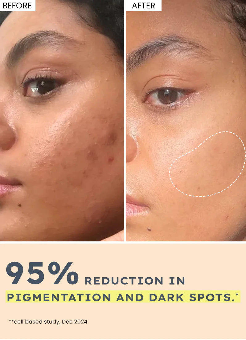 Hyphen 44% Rice Water Brightening Serum Pads - 50 Pads