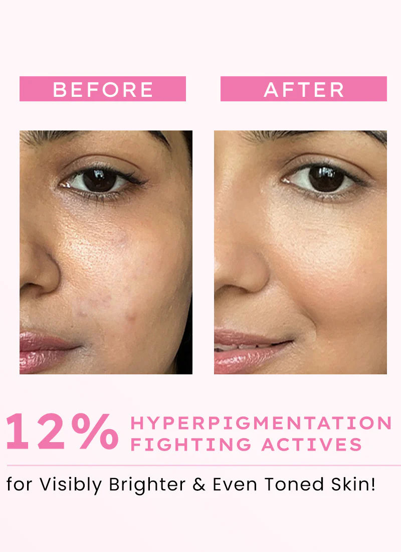 Hyphen Advanced De- Pigmentation Serum