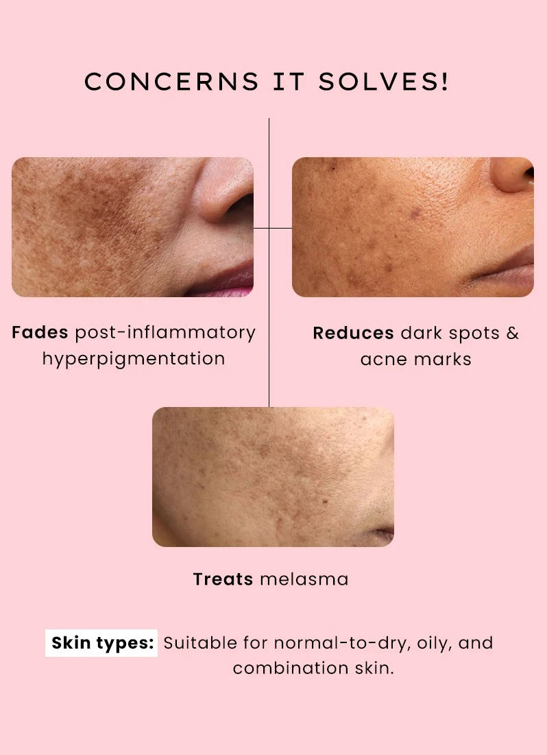 Hyphen Dual Phase De-pigmentation Serum (4% Tranexamic Acid) - 30ml