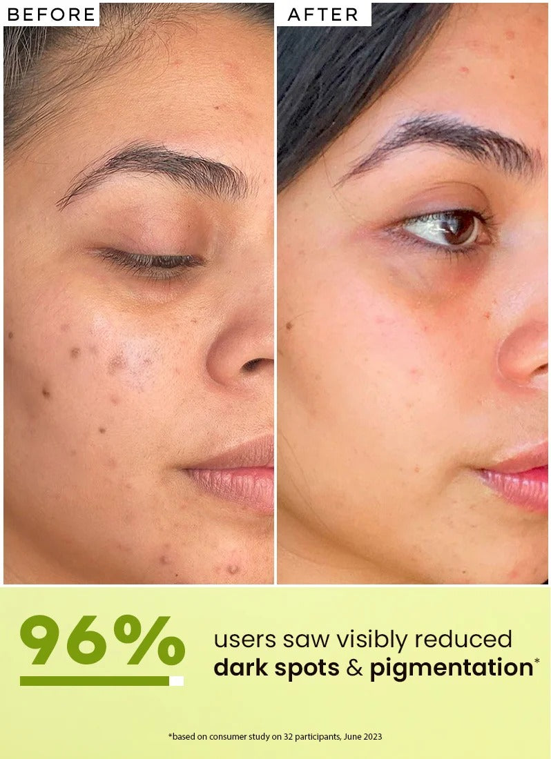 Hyphen Golden Hour Glow Face Serum - 30ml