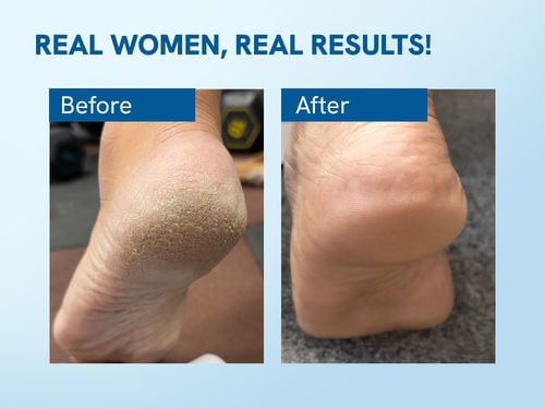 Be Bodywise Foot Roll On (50ml) + Hair Growth Serum (25ml) Combo