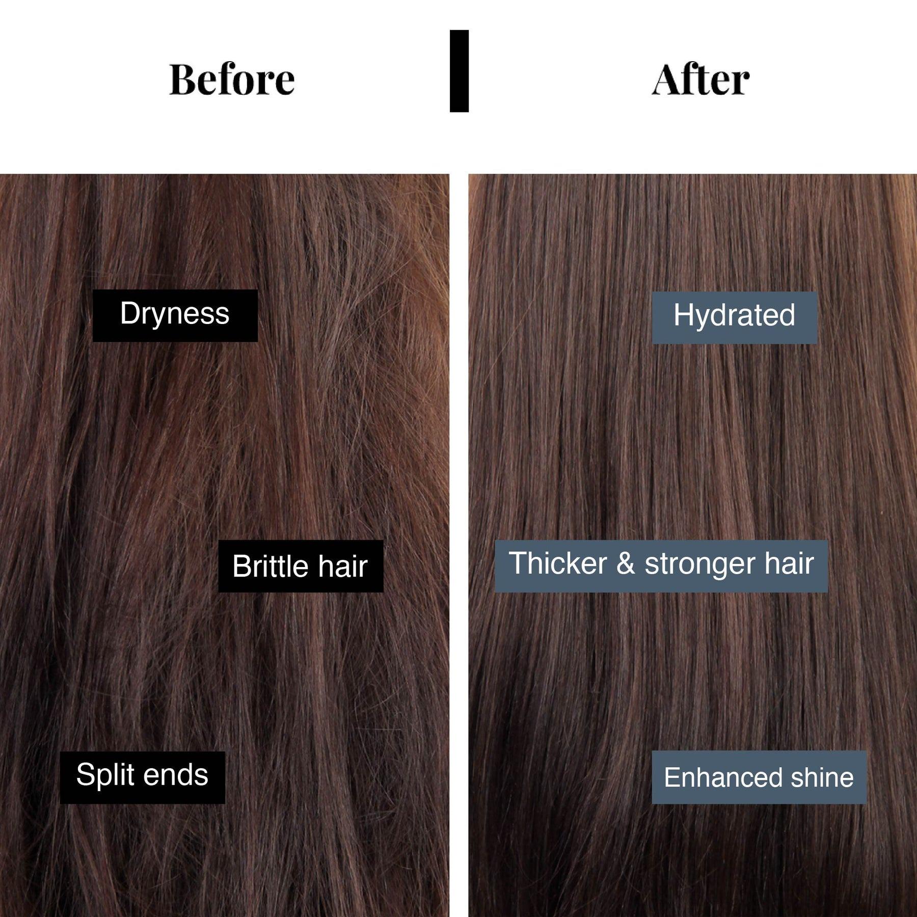 Bare Anatomy Hair Fall Control Shampoo with Peptides