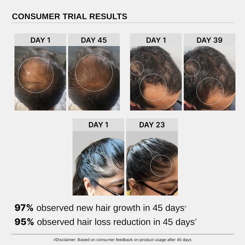 Bare Anatomy Advanced Hair Growth Serum (30 ml) - Pack of 2