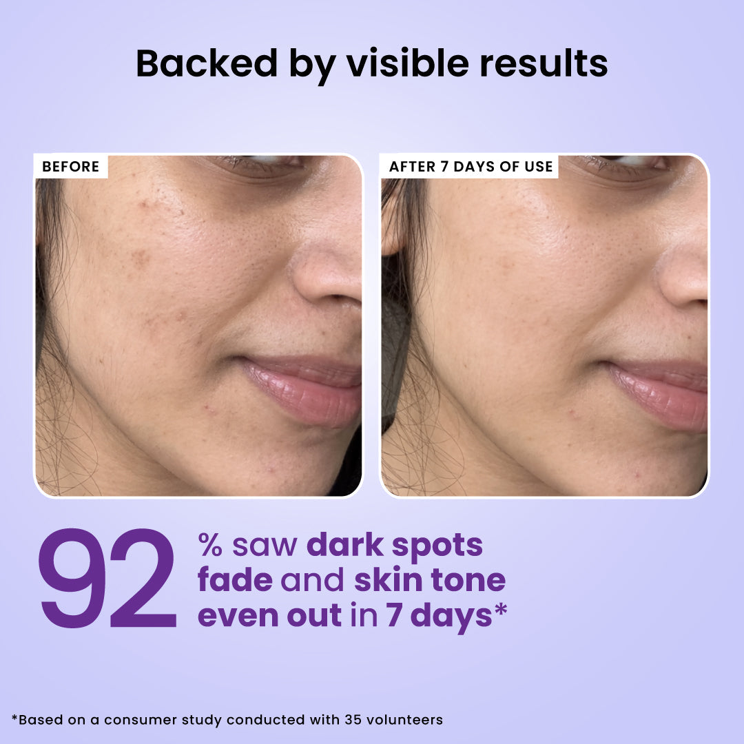Foxtale 7% Niacinamide Brightening Complex Serum