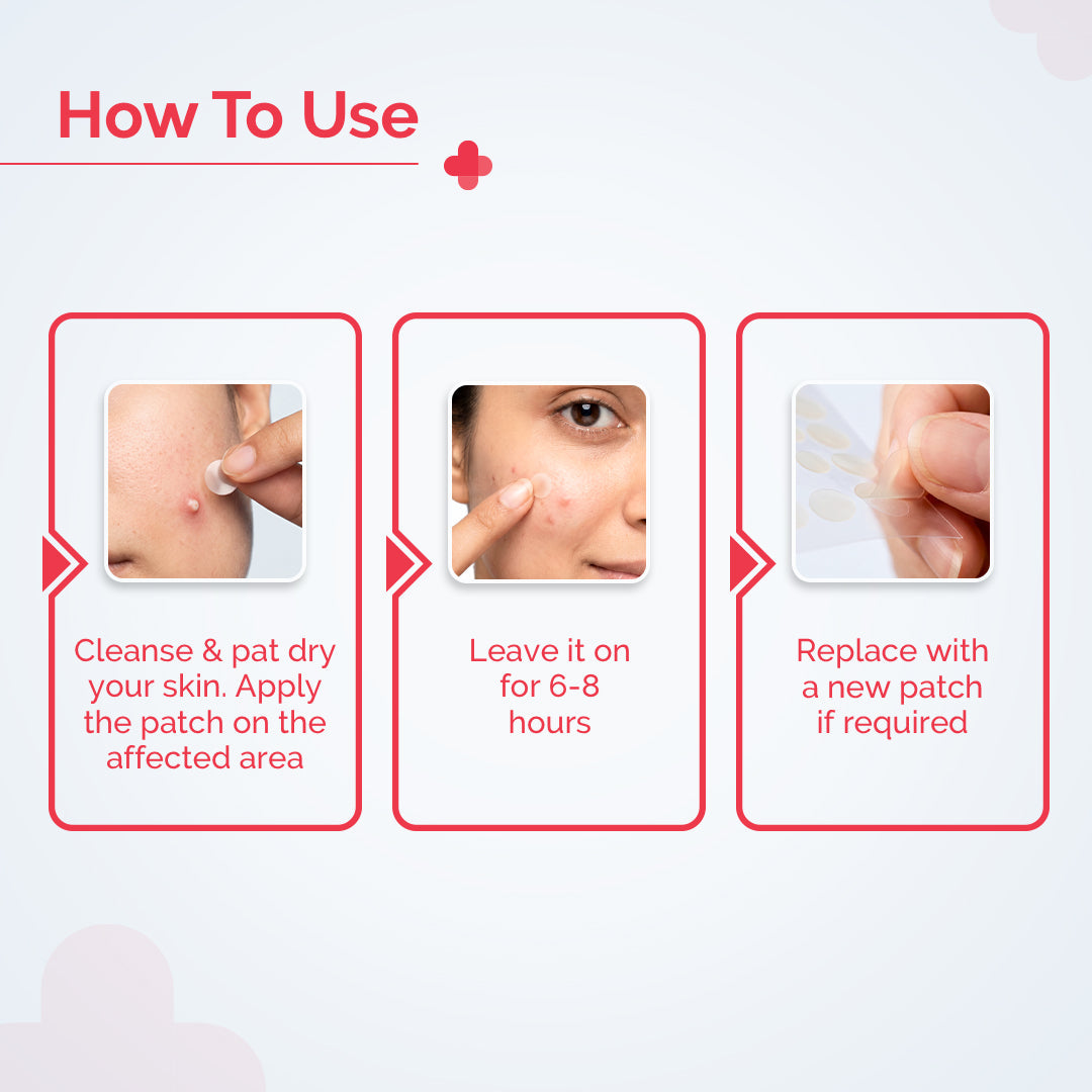 Derma Co 2% Sali-Cinamide Hydrocolloid Acne Patches - 36 Patches