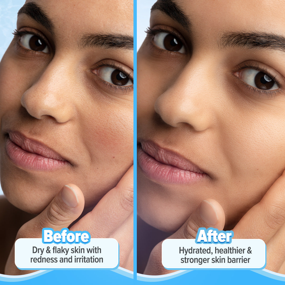 Aqualogica Barrier+ Repair Moisturizer