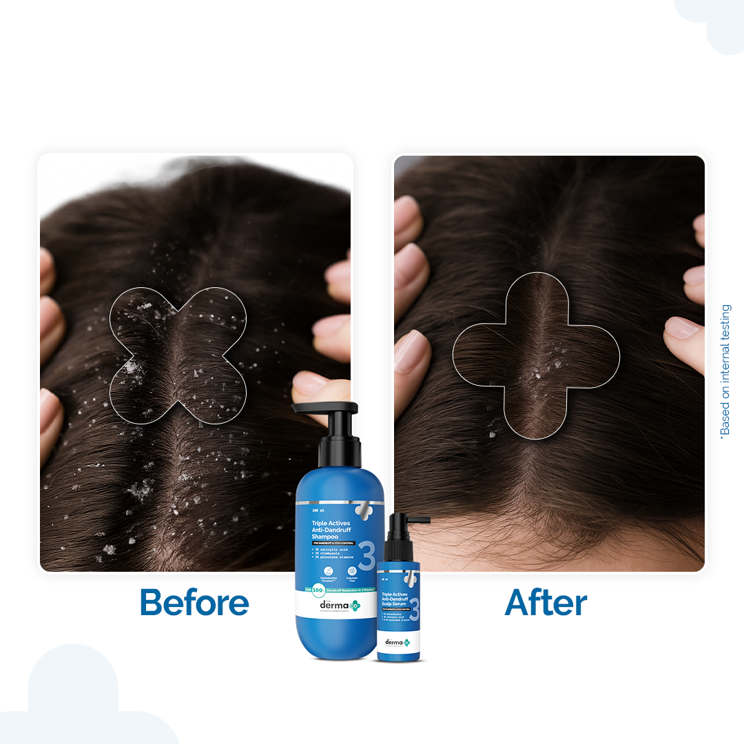 Derma Co Triple Actives Anti-Dandruff Control Combo