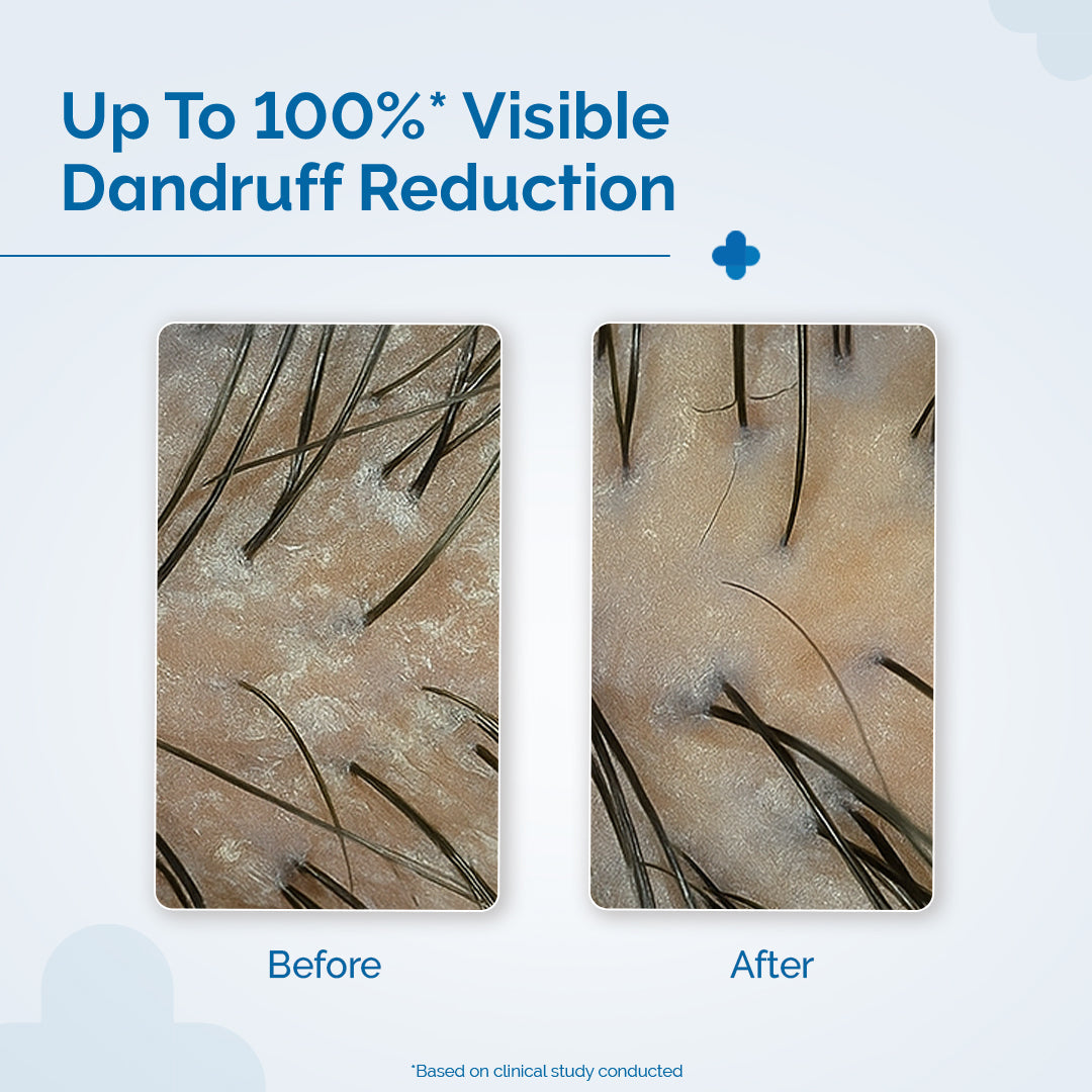 Derma Co Triple Actives Anti-Dandruff Shampoo