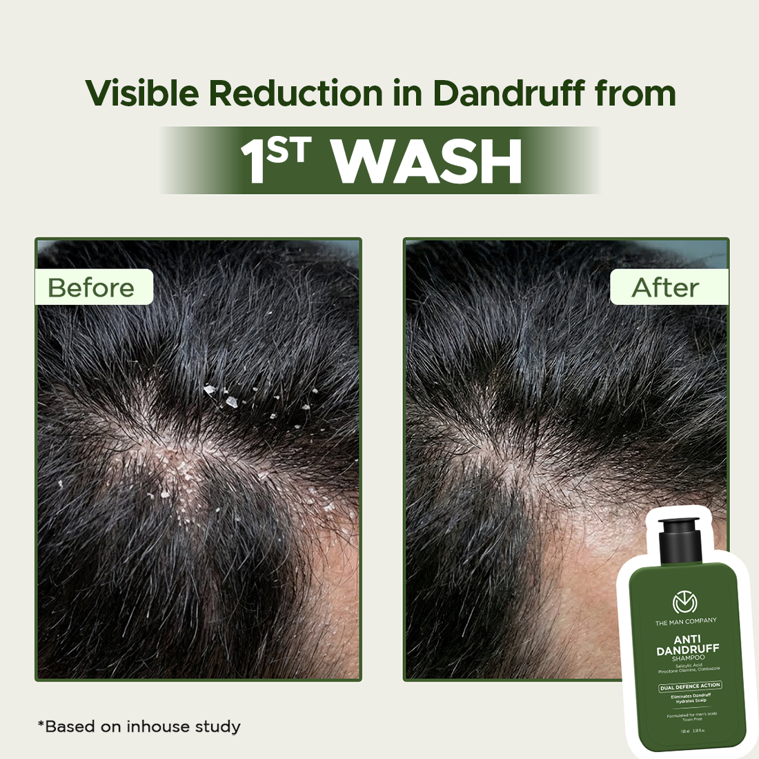 The Man Company Anti-Dandruff Shampoo for Men - 100ml