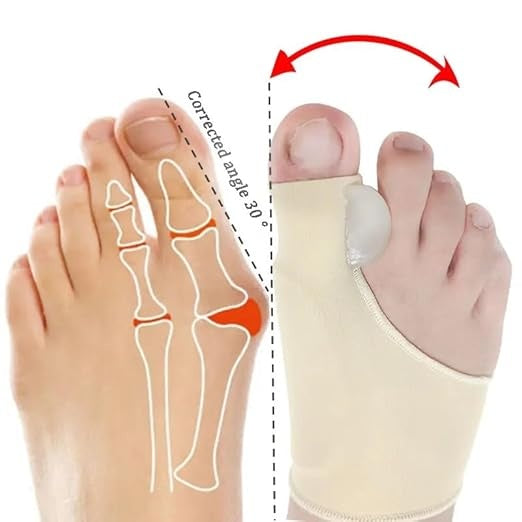 Aegon Bunion Corrector