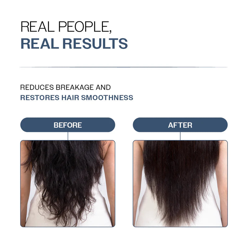 Bare Anatomy Anti-Hair Fall Shampoo & Conditioner Combo