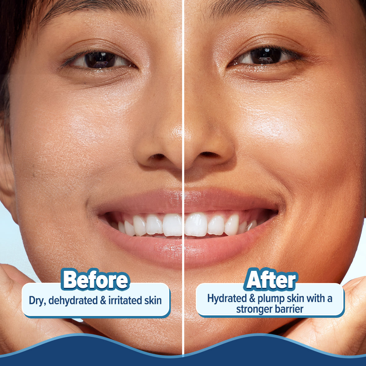 Aqualogica Barrier+ Hydra Gel Moisturizer