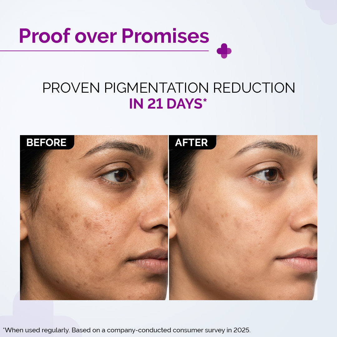Derma Co 2% Kojic Acid Face Serum