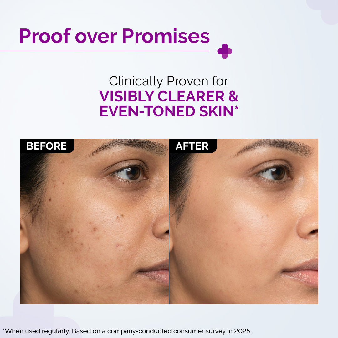 Derma Co 10% Niacinamide Face Serum with 2% Zinc PCA