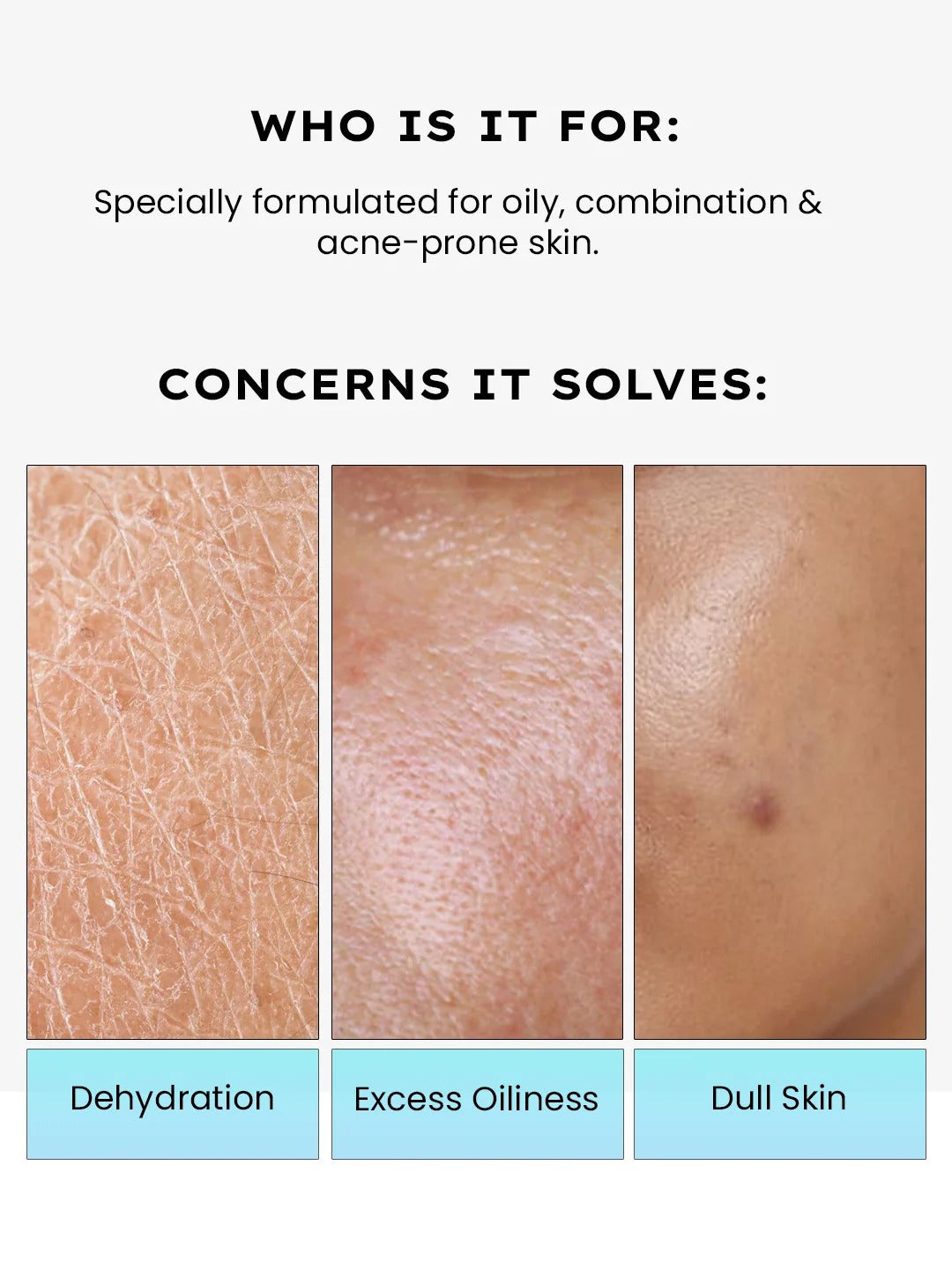Hyphen 2% cica exosomes oil-free moisturizer - 100ml
