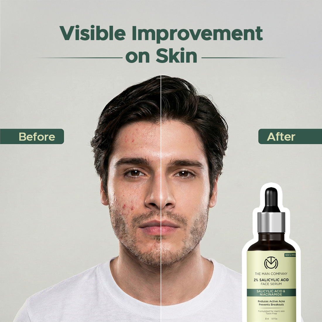 The Man Company 2% Salicylic Acid Anti-Acne Face Serum