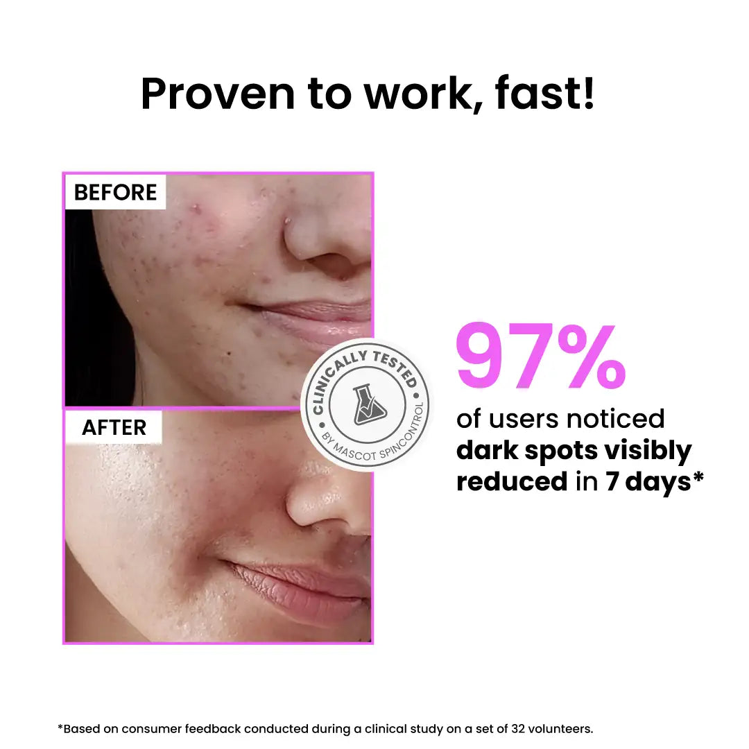 Foxtale Oil & Acne Control Face Wash - 100ml + 12% Niacinamide Clarifying Serum - 30ml (Combo)