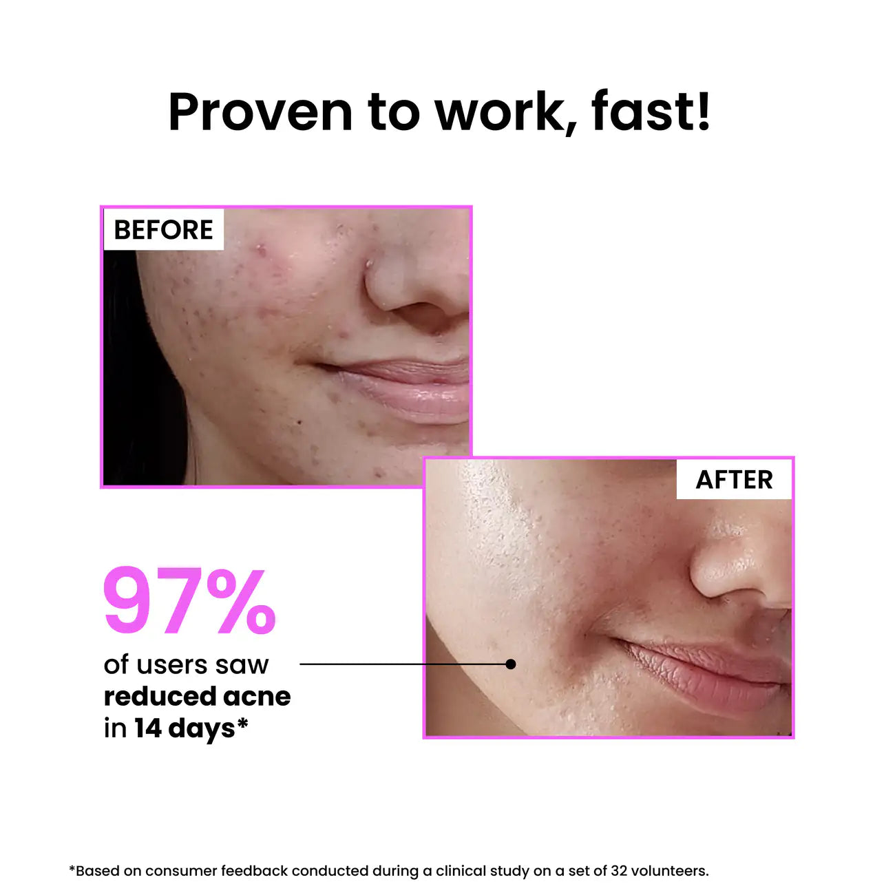 Foxtale 12% Niacinamide Clarifying Serum - 30ml
