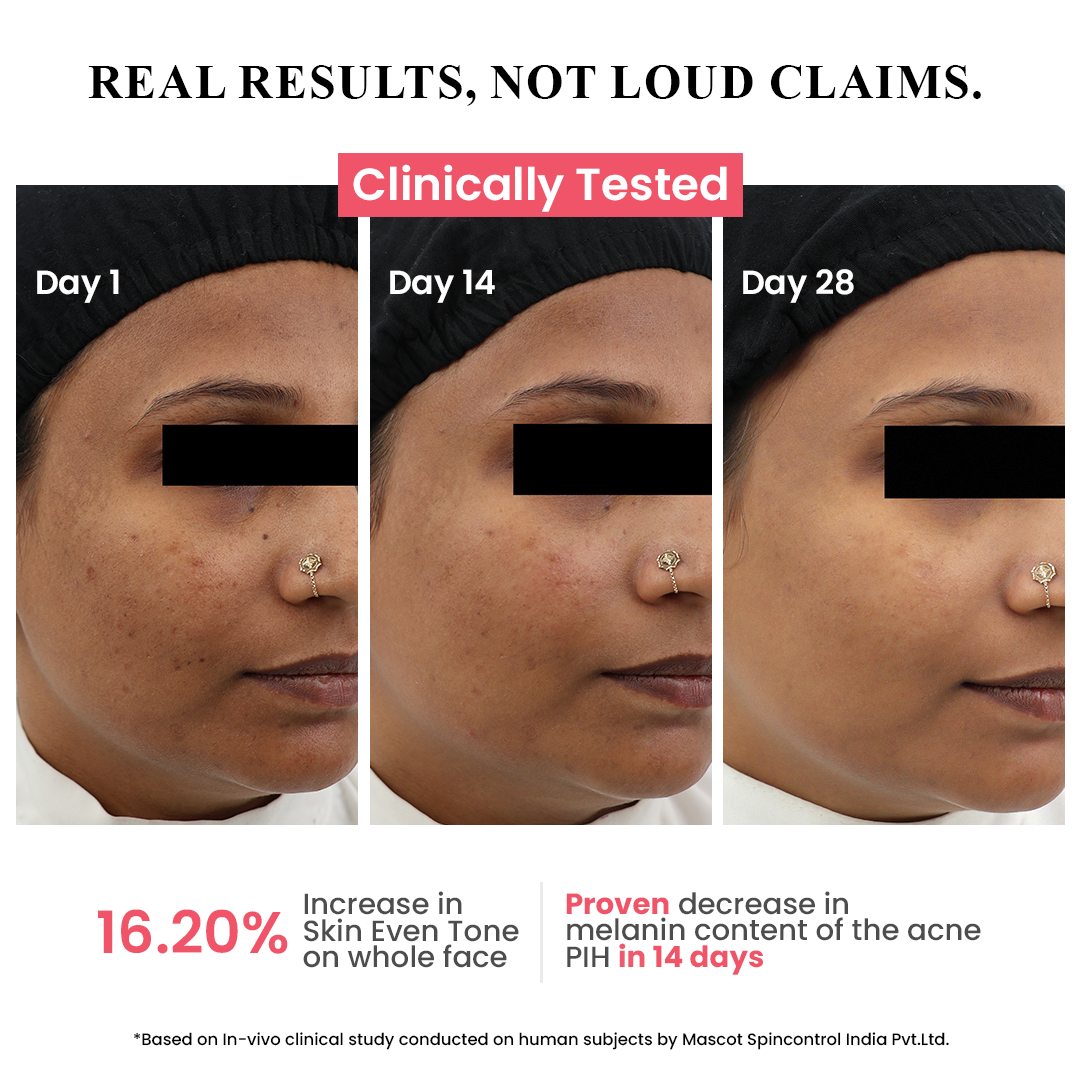 ClayCo Hyperpigmentation Mushroom Complex Serum with Tranexamic Acid - 30 ml