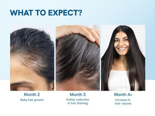 Be Bodywise Total Hair & Health Nutrition Trio