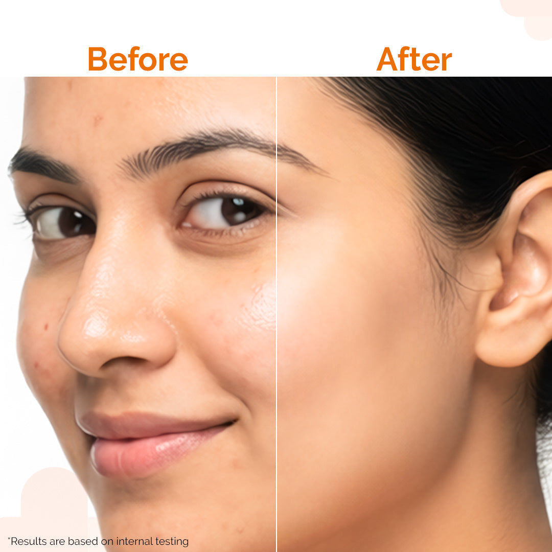 Derma Co Pore Minimizing Sunscreen Gel SPF 50 PA+++
