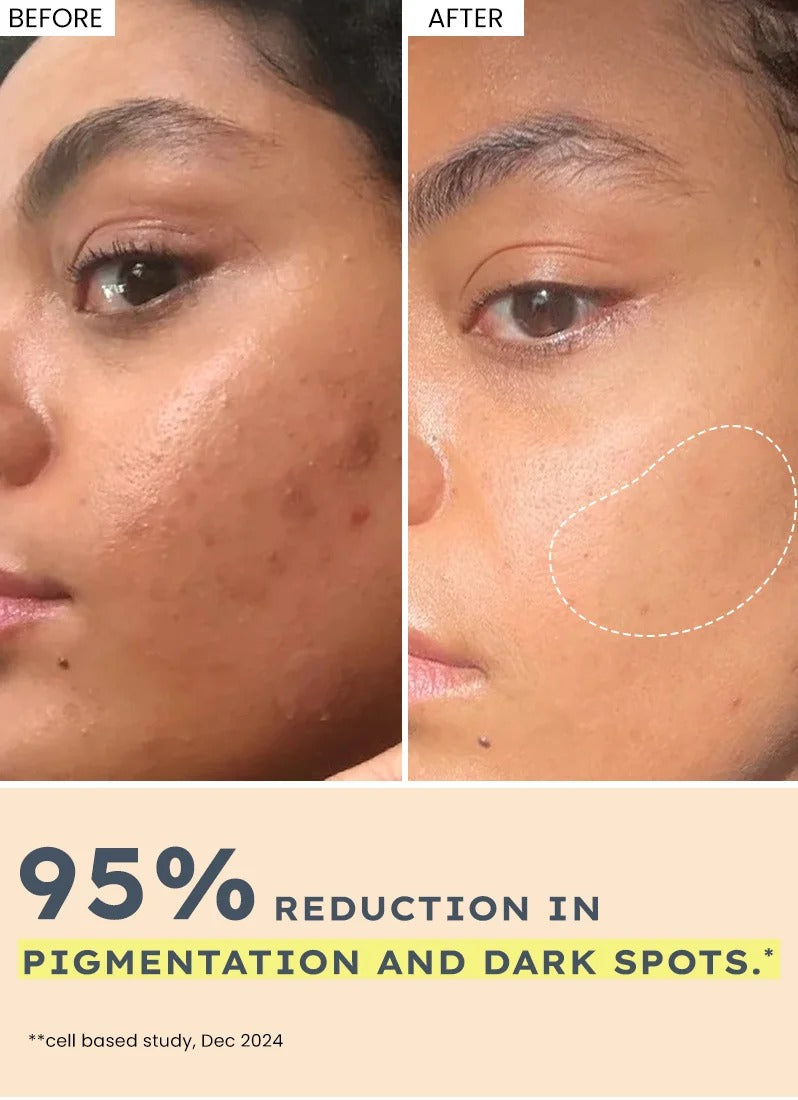Hyphen 44% Rice Water Brightening Serum Pads - 50 Pads