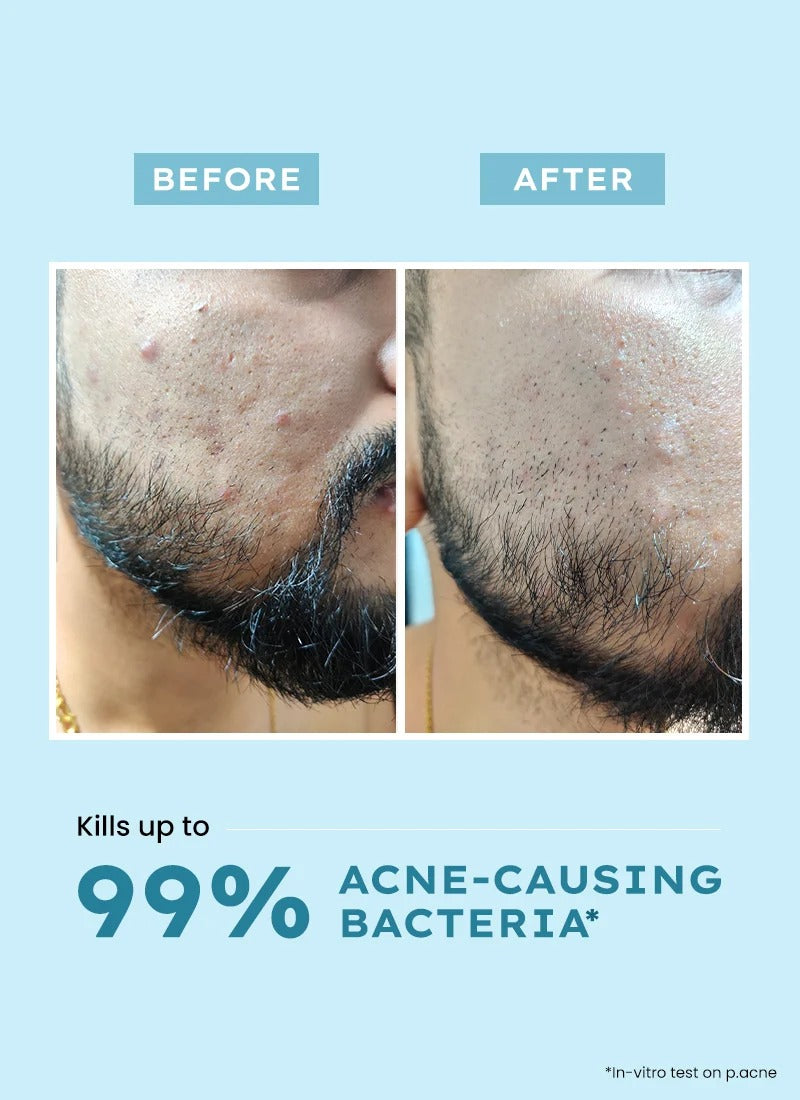 Hyphen Clarifying Acne Face Wash - 100ml