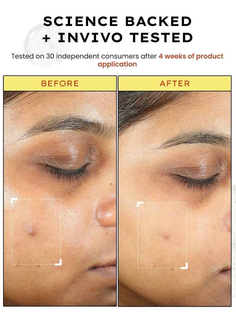 Hyphen 10% Vit C Serum with 1% Vit E & Ferulic Acid - 20ml