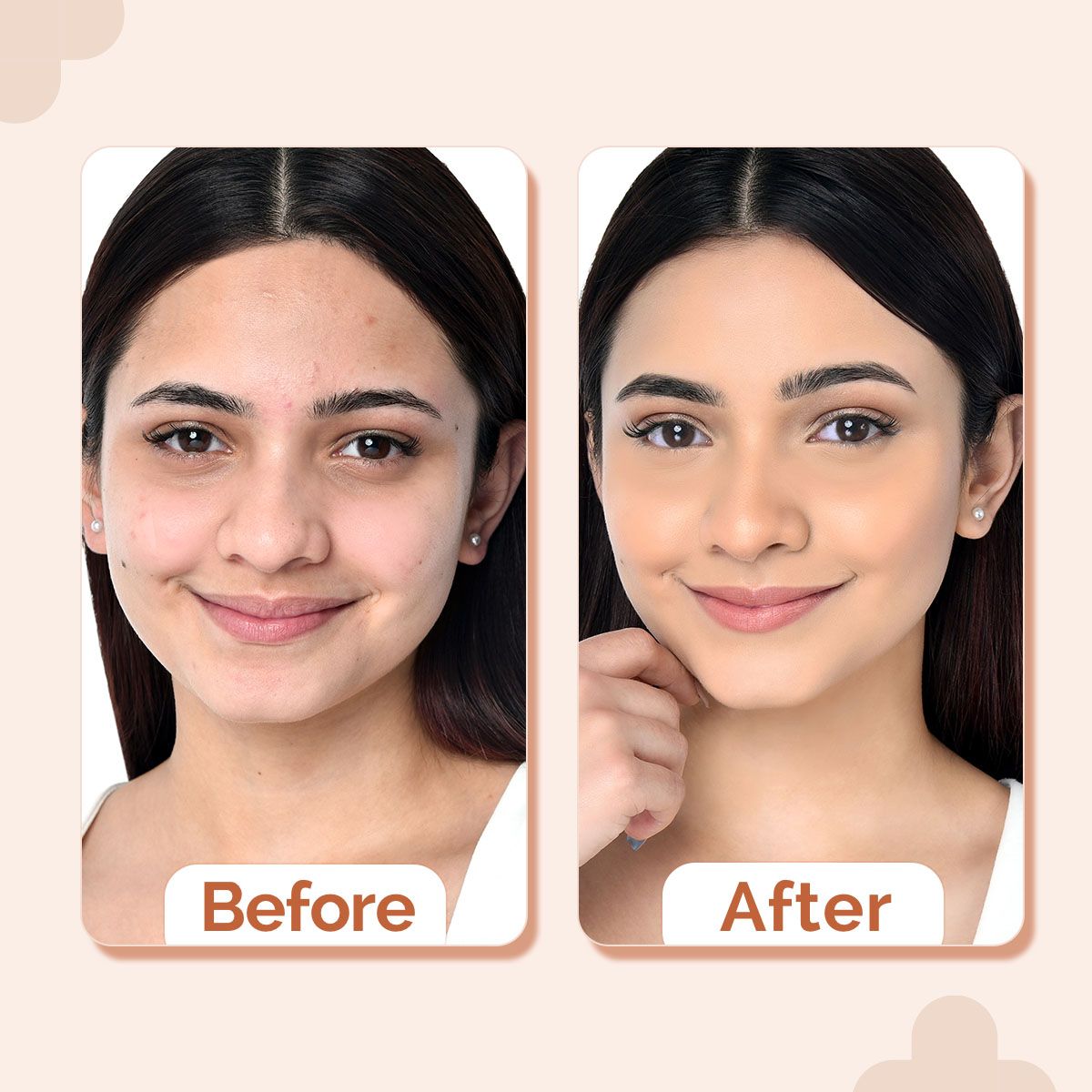 Derma Co 2% Niacinamide High Coverage Foundation With 1% Hyaluronic Acid Complex & SPF 40 PA+++